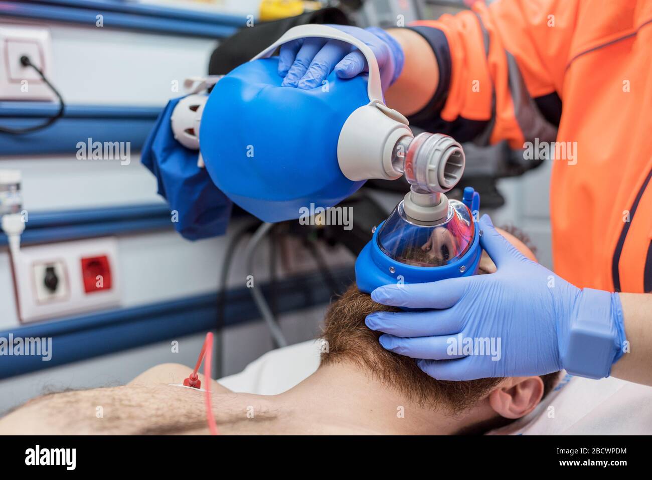 Covid-19 insuficiencia respiratoria. Médico de urgencia con mascarilla bolsa de Ambu en un paciente con neumonía por infección por coronavirus, para ventilación artificial . Foto de stock