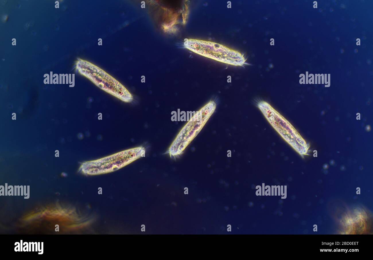Diversidad protozoaria en un estanque de jardín, Hypotrichs Foto de stock