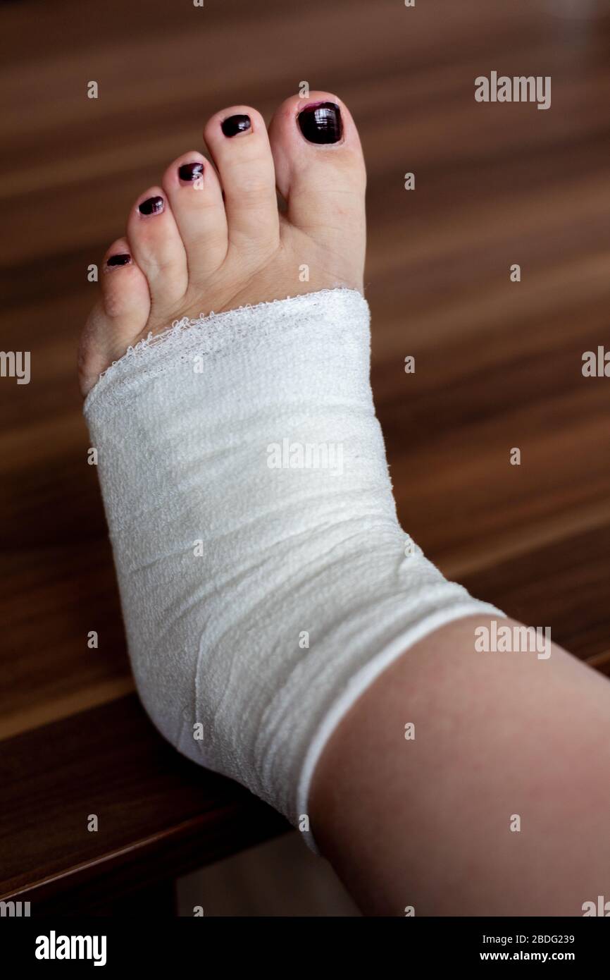 La mujer está envolviendo su lesión en el pie con un vendaje Fotografía