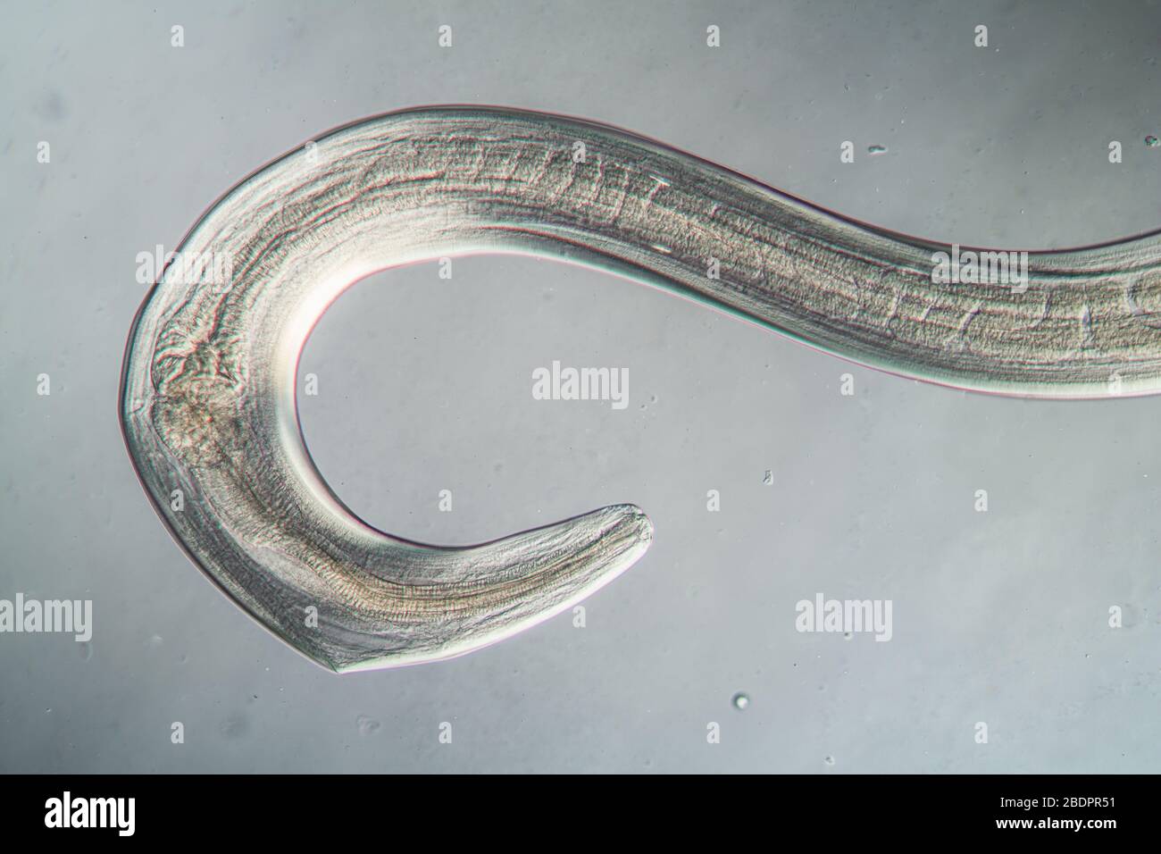 Nematodo gusano parasitico bajo el microscopio 100x Foto de stock