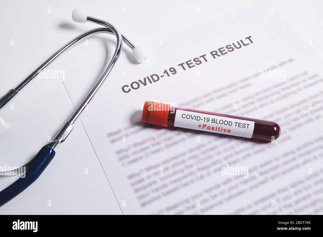 Resultado positivo de la prueba para coronavirus, análisis rápido de sangre para coronavirus o pandemia de Covid-19 Foto de stock