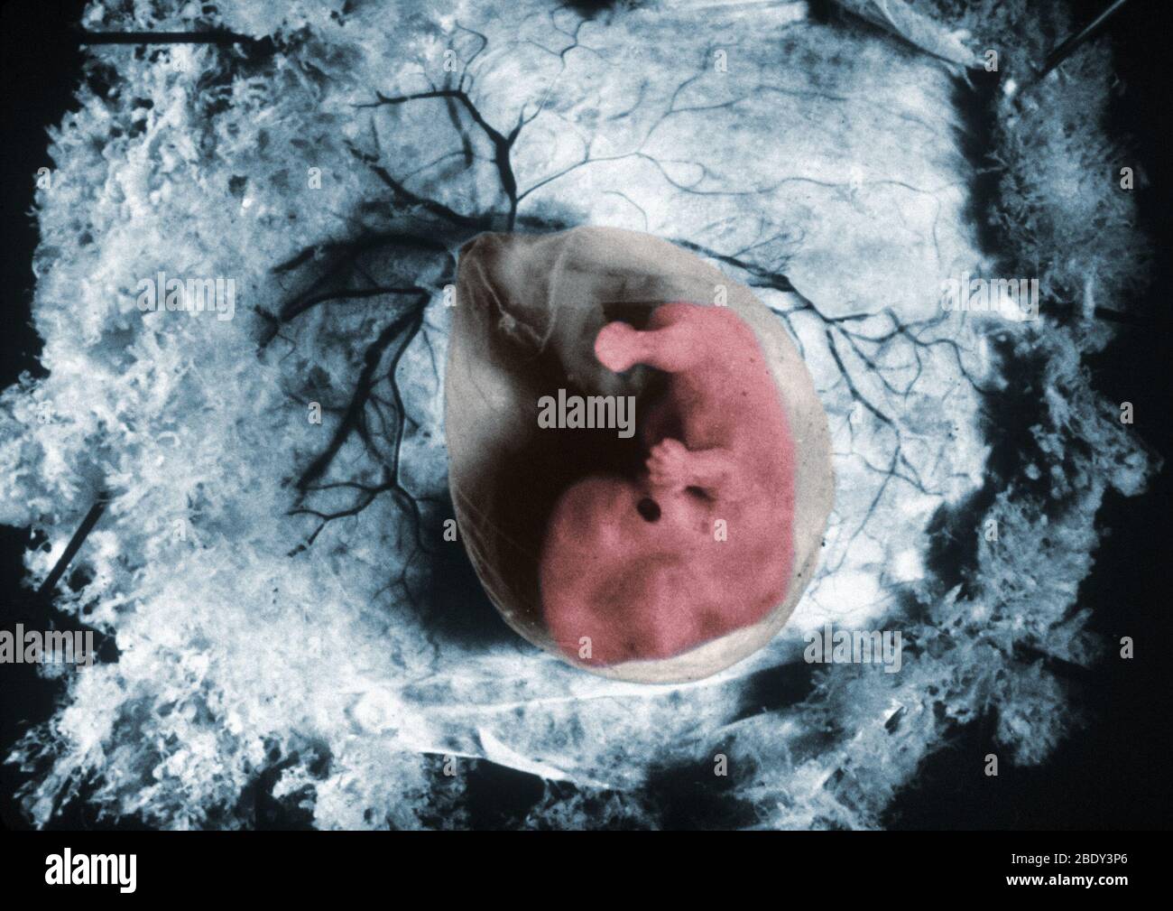 Embrión humano Foto de stock