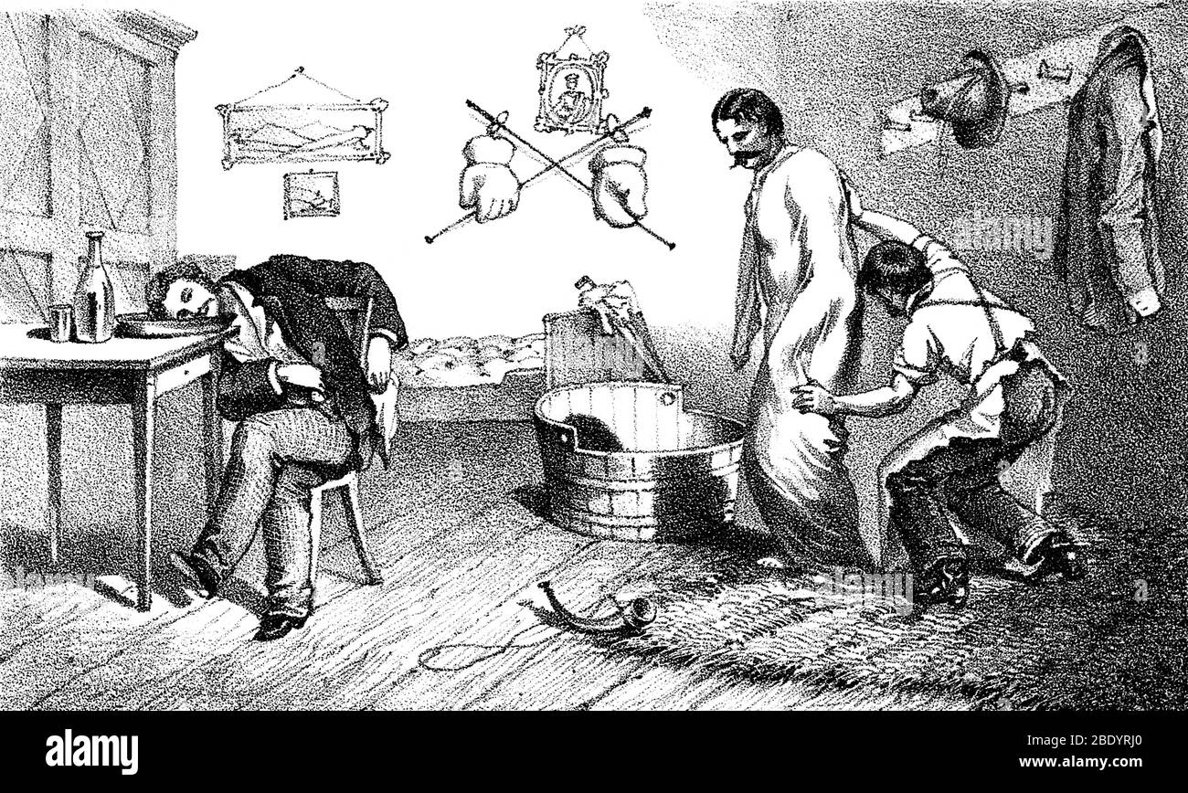 Hidroterapia, baño de cabeza y lavado de abrasión, 1860 Foto de stock