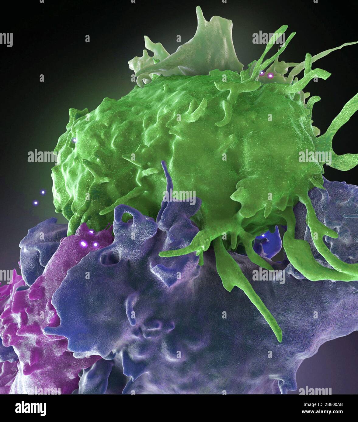 Las personas infectadas de VIH y células T normales interactuar, FIB-SEM Foto de stock