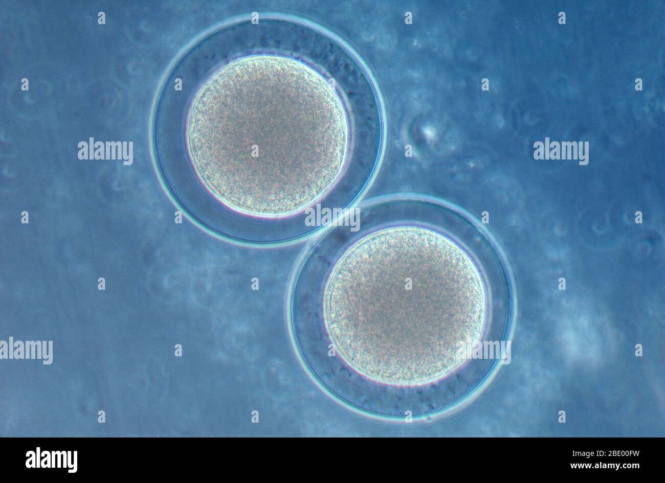 Embriones de erizos de mar Foto de stock
