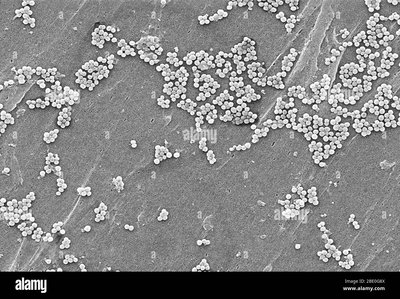 Este micrográfico electrónico de barrido representa una agrupación de bacterias Staphylococcus aureus resistentes a la meticilina (MRSA). Son de uno de los primeros aislados en los Estados Unidos que mostraron mayor resistencia a la vancomicina también. Observe el aumento en el material de la pared celular visto como grupos en la superficie del organismo. Los brotes o conglomerados de SARM recientemente reconocidos en entornos comunitarios se han asociado a cepas que tienen propiedades microbiológicas y genéticas únicas en comparación con las cepas de SARM tradicionales de origen hospitalario. Esto sugiere que algunas propiedades biológicas, por ejemplo, factores de virulencia li Foto de stock