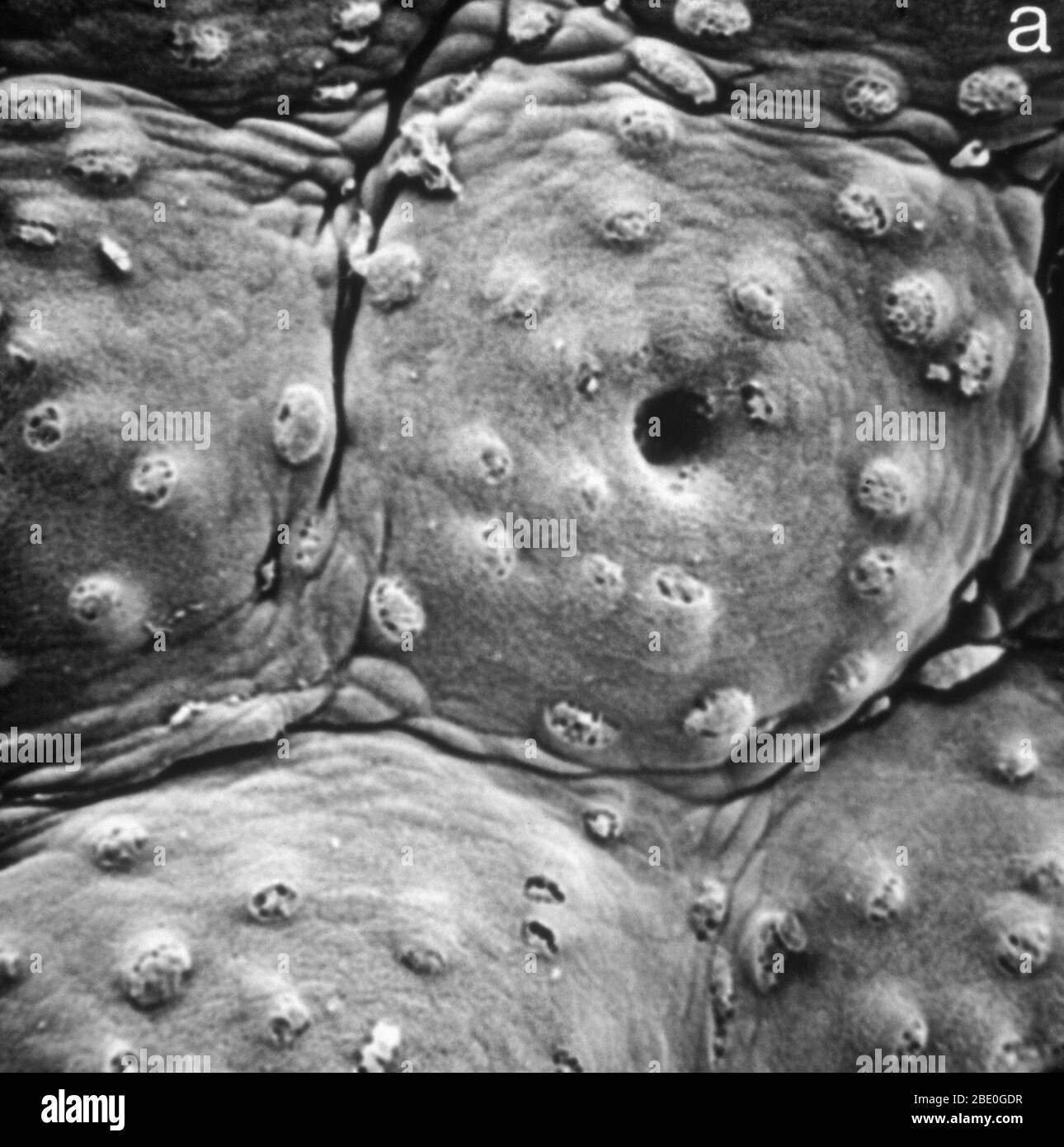 SEM (Micrografía de electrones de exploración) de la superficie del intestino grueso (humano) mostrando unidad poligonal con cripta central. Ampliación x650. Foto de stock