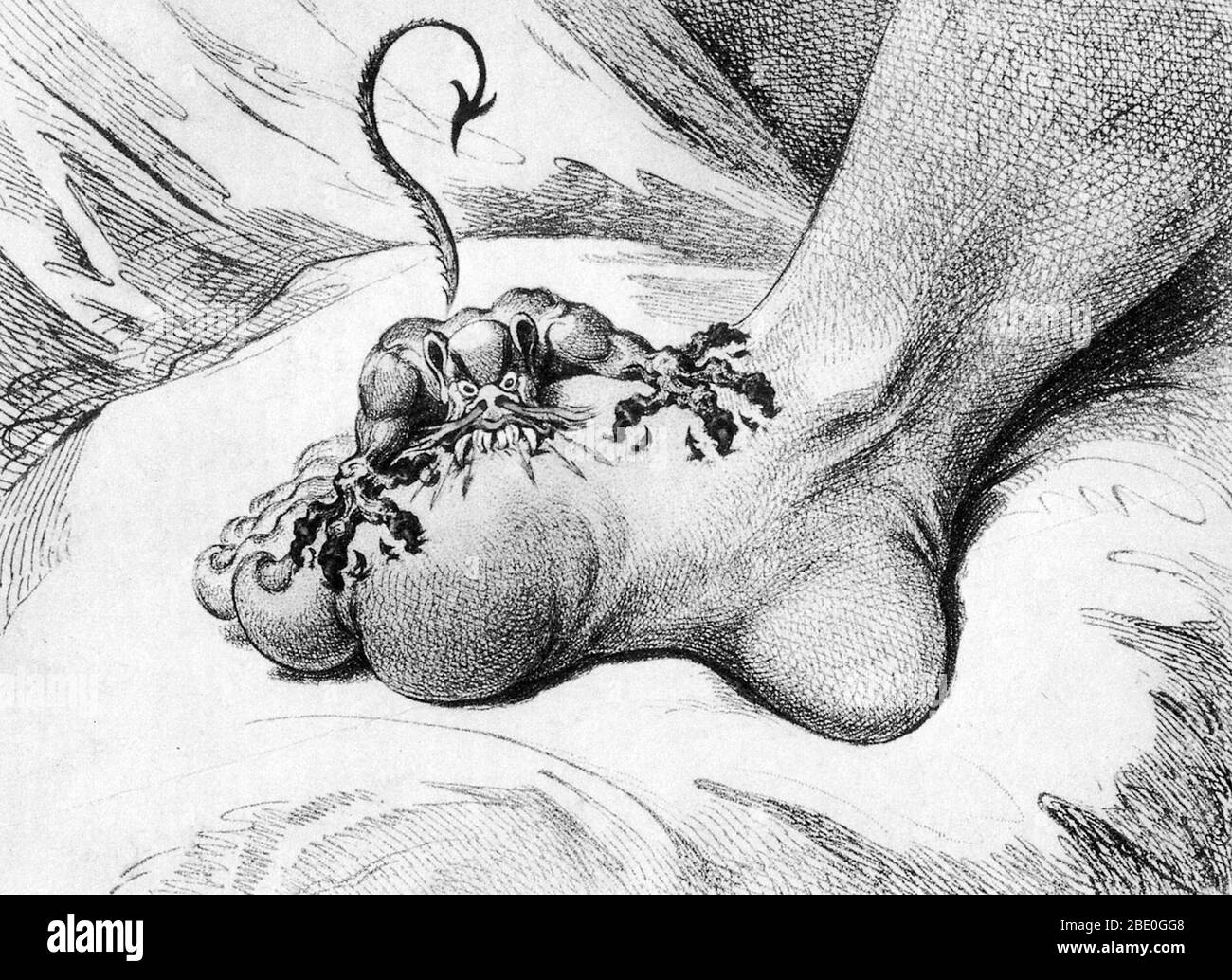 Ilustración que representa el dolor asociado con la gota. Grabado por James Gillray, 1799. Foto de stock
