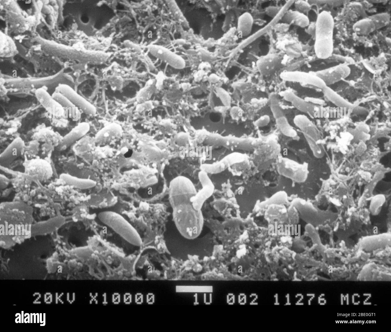 Exploración de micrografía electrónica (SEM) de aguas residuales sin procesar filtradas en una membrana de nucleóforos. Observe las bacterias incrustadas en material orgánico. Aumento 100,000x a un tamaño de imagen de 35 mm. Foto de stock