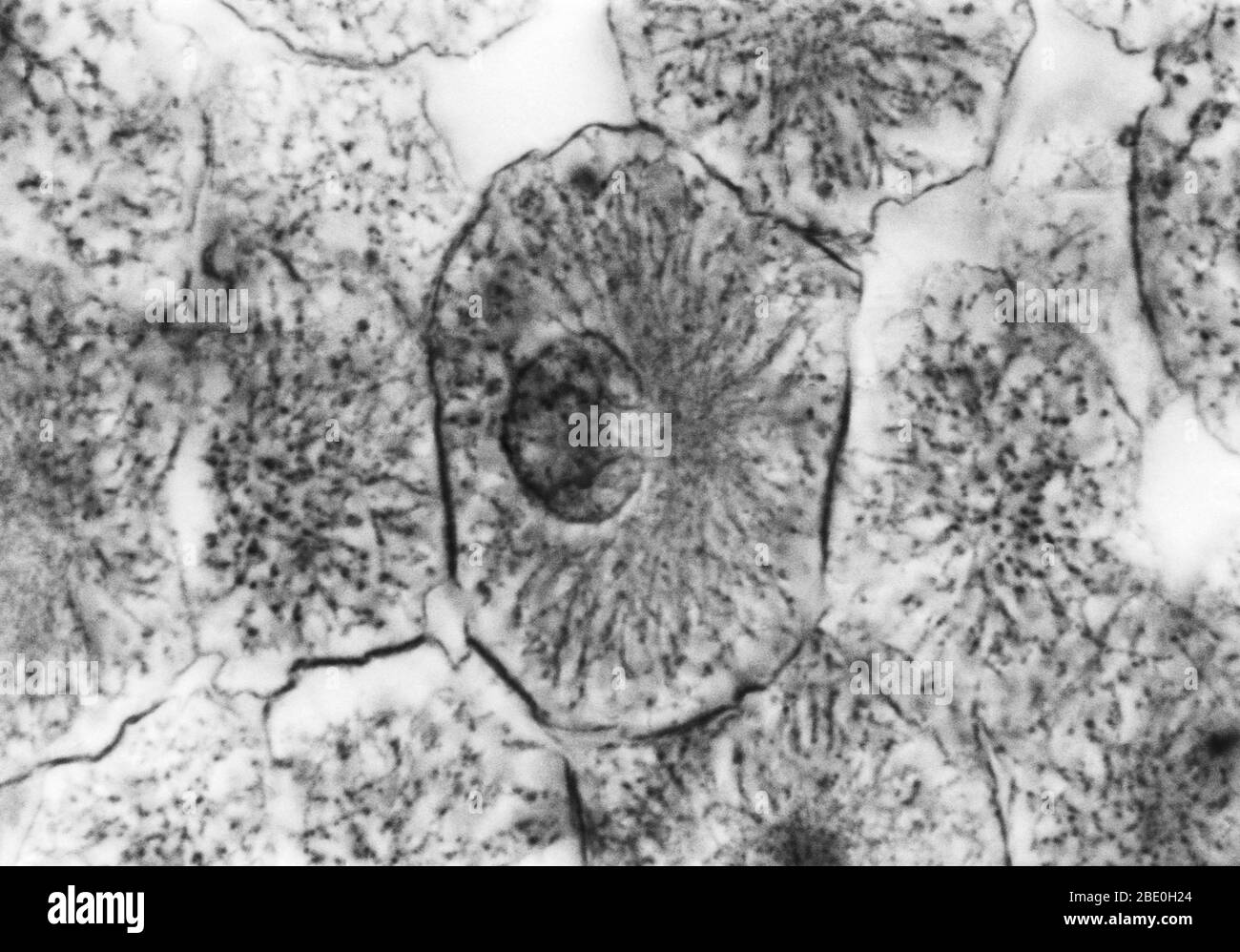 Micrografo ligero que muestra mitosis en blastula blanca, profase. No se ha proporcionado ampliación. Mitosis, el método habitual de división celular, caracterizado típicamente por la resolución de la cromatina del núcleo en forma de hilo, que se condensa en cromosomas, cada uno de los cuales se separa longitudinalmente en dos partes, una parte de cada cromosoma que se retiene en cada una de las dos células nuevas que resultan de la célula original. Las cuatro fases principales de la mitosis son la profase, la metafase, la anafase y la telofase. Blastula, un embrión animal en la etapa inmediatamente posterior a la división del óvulo fertilizado Foto de stock