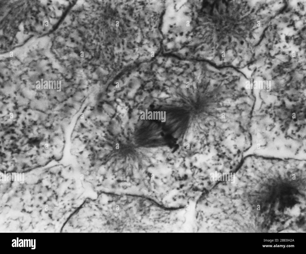 Micrografo ligero que muestra mitosis en la blastula blanca, metafase. No se ha proporcionado ampliación. Mitosis, el método habitual de división celular, caracterizado típicamente por la resolución de la cromatina del núcleo en forma de hilo, que se condensa en cromosomas, cada uno de los cuales se separa longitudinalmente en dos partes, una parte de cada cromosoma que se retiene en cada una de las dos células nuevas que resultan de la célula original. Las cuatro fases principales de la mitosis son la profase, la metafase, la anafase y la telofase. Blastula, un embrión animal en la etapa inmediatamente posterior a la división del fertilizado eg Foto de stock