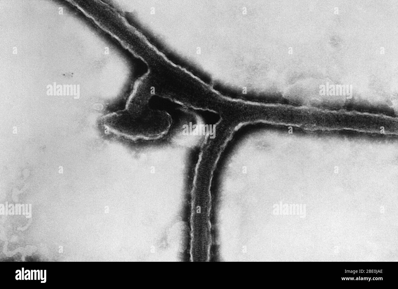 Micrografia Electronica De Transmision Tem Del Virus De Marburg El Virus Marburg Marv Es Un Virus De La Fiebre Hemorragica De La Familia Filoviridae Y Es Miembro De La Especie Marburg Marburgvirus