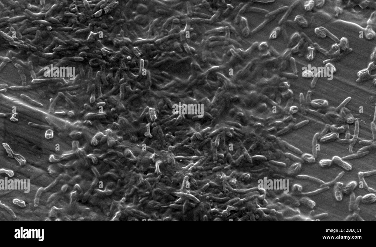 SEM de una biopelícula de agua potable (potable) de laboratorio antes de la introducción de los quistes de Vermamoeba vermiformis (Hartmanella). Las bacterias acuáticas se cultivaron como biopelícula en acero durante una semana. Se añadió V. vermiformis y se fagocitaron las bacterias que se multiplicaron dentro de las vesículas y se convirtieron en quistes en los que la bacteria vivirá hasta su ruptura. Vermamoeba vermiformis es una ameba de vida libre (FLA), está muy extendida en la naturaleza y ha sido aislada del suelo, agua dulce, aire, y una variedad de sistemas de agua diseñados. Dos formas distintas del ciclo de vida son conocidas por Vermamoeba vermiformis, el trop Foto de stock