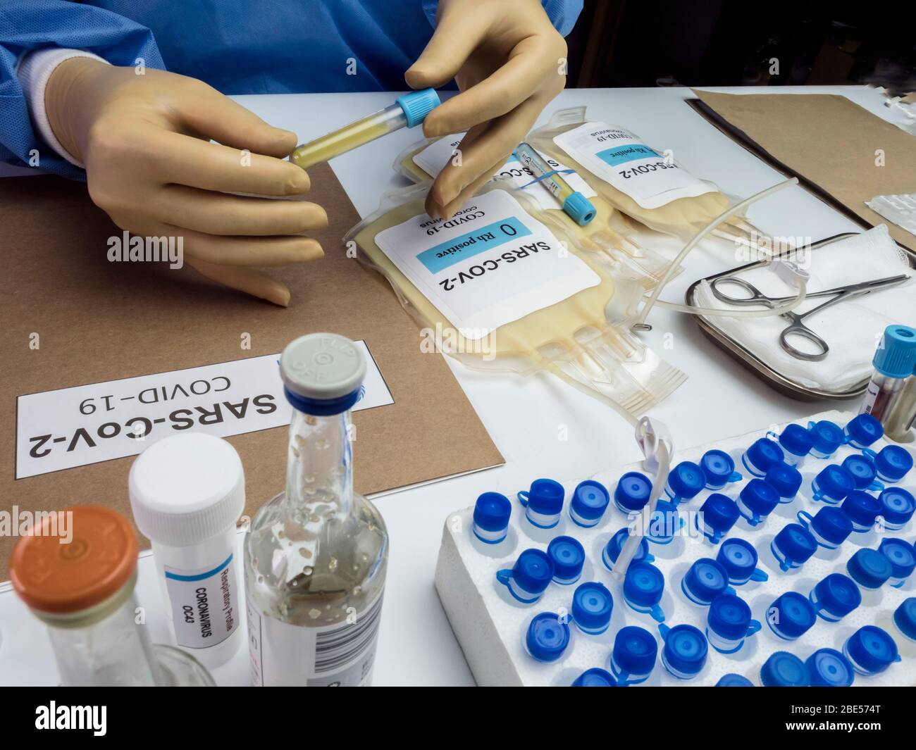 Bolsa de plasma con anticuerpos de personas curadas de SARS-COV-2 Covid-19 preparada en un hospital, imagen conceptual Foto de stock