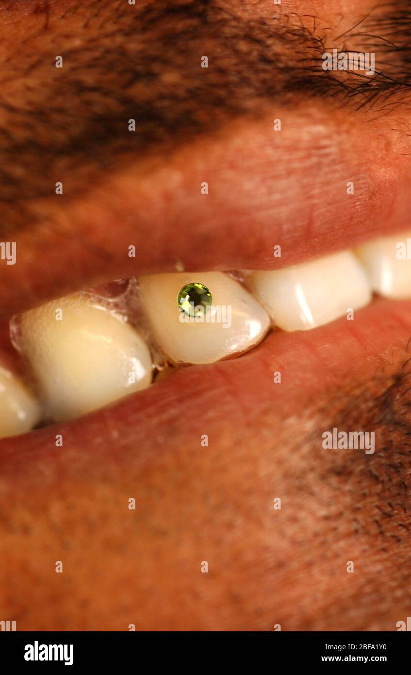 Los dientes postizos Falsies para hombres Fotografía de stock - Alamy