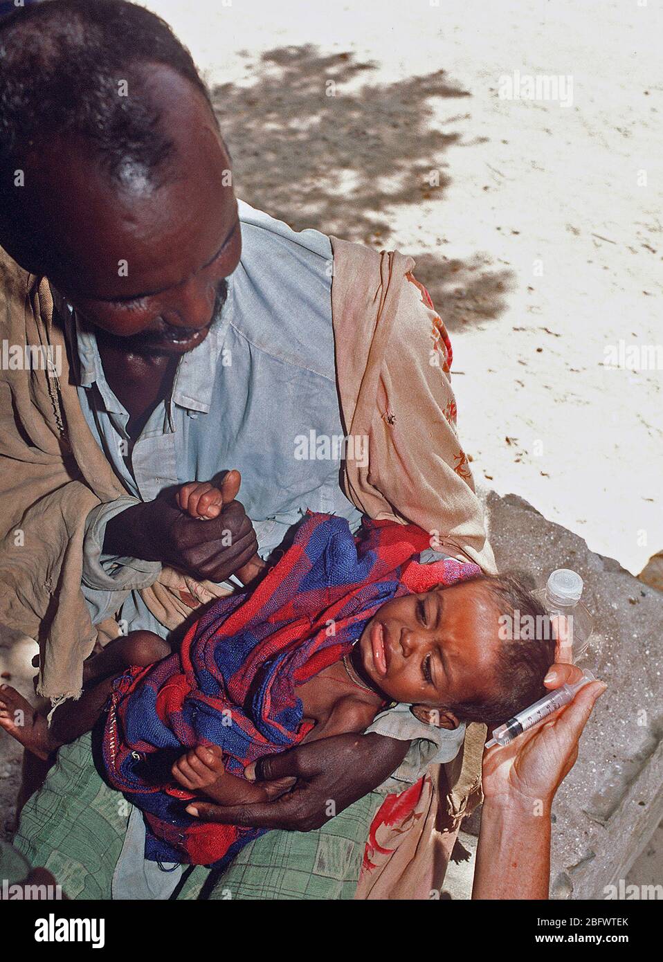 1993 - Un niño llora de refugiados somalíes, después de habérseles dado agua a través de una jeringa en una estación de ayuda establecido durante la operación Restaurar la esperanza los esfuerzos de socorro. Bardera (Somalia) Foto de stock