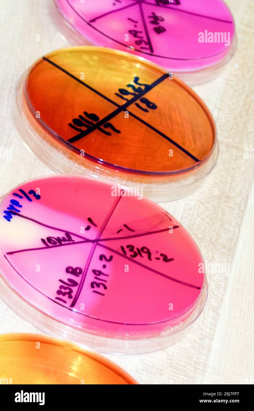 Primer plano de placas Petri para pruebas médicas y cultivo de células en un laboratorio de biología Foto de stock