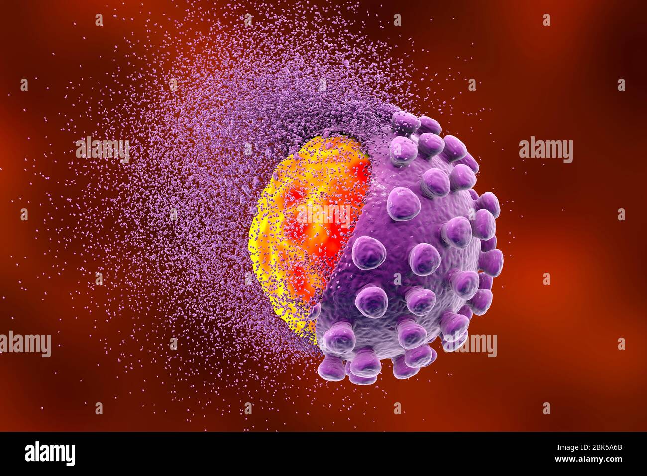 Erradicando el coronavirus covid-19, ilustración conceptual. El nuevo coronavirus SARS-CoV-2 (anteriormente 2019-CoV) surgió en Wuhan, China, en diciembre de 2019. El virus causa una enfermedad respiratoria leve (Covid-19) que puede convertirse en neumonía y ser mortal en algunos casos. Los coronavirus toman su nombre de su corona (corona) de proteínas de punta superficial (grandes protuberancias), que se utilizan para unir y penetrar sus células huésped. Foto de stock