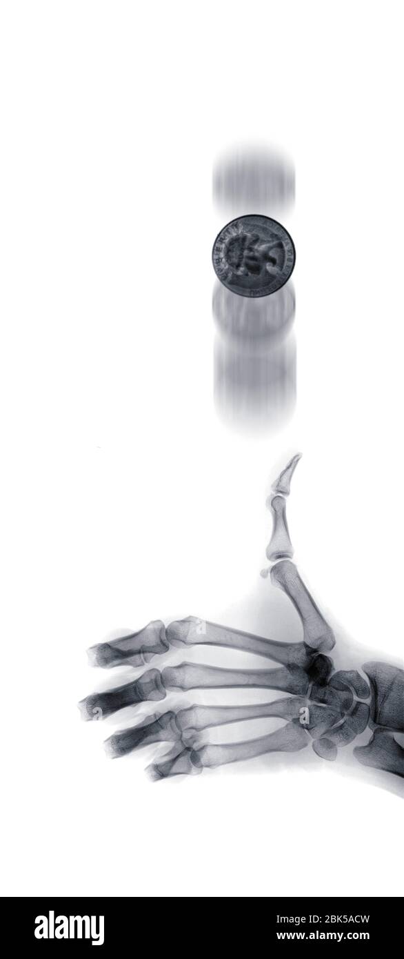 Mano humana volteando una moneda, rayos X. Foto de stock