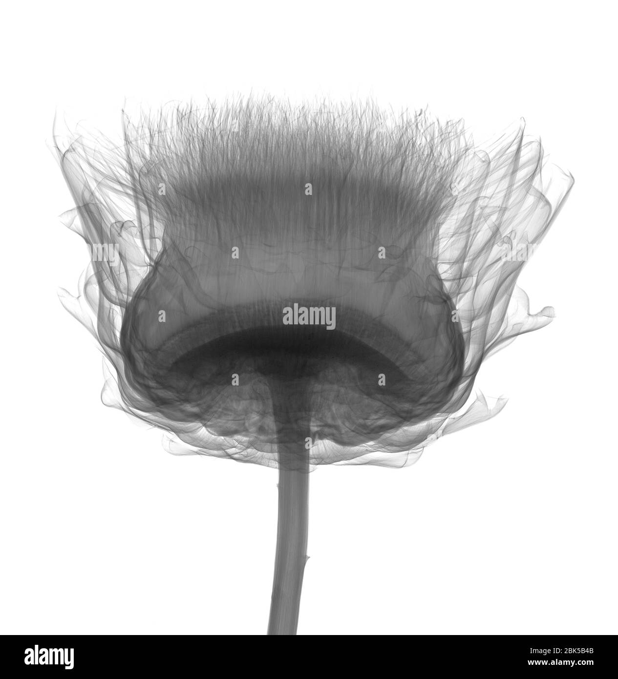 Thistle (Carlina sp.), rayos X. Foto de stock