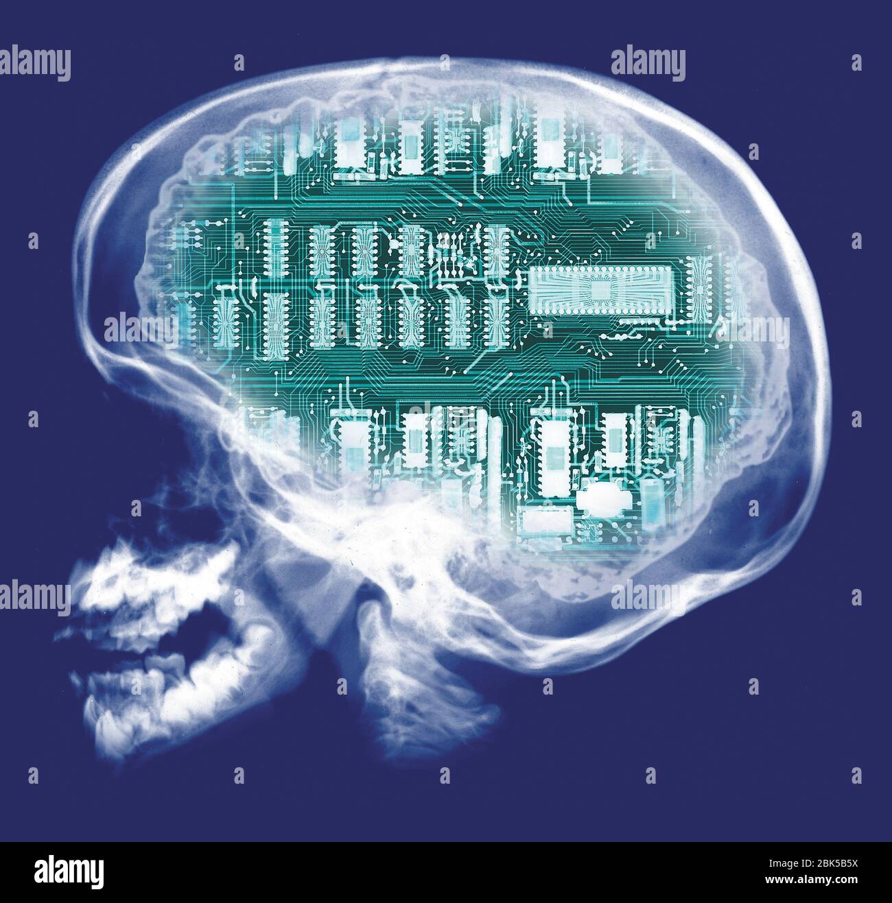 Cráneo humano y placa de circuitos de computadora, rayos X de color. Foto de stock