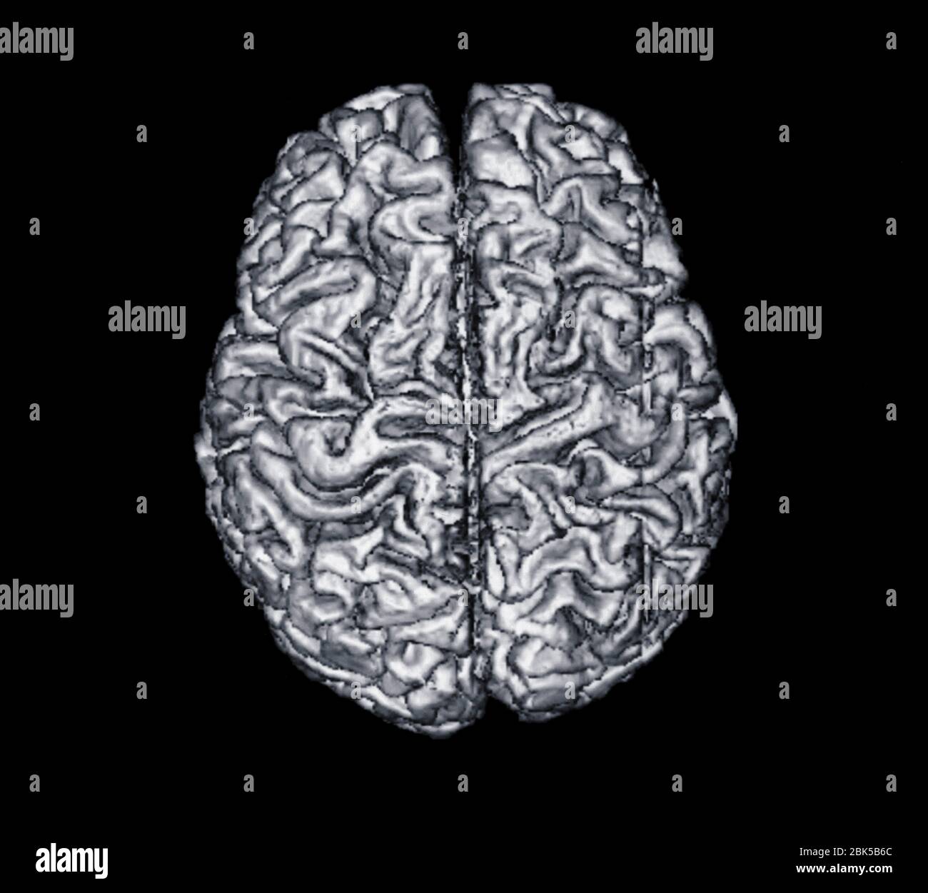 Cerebro desde arriba, rayos X. Foto de stock