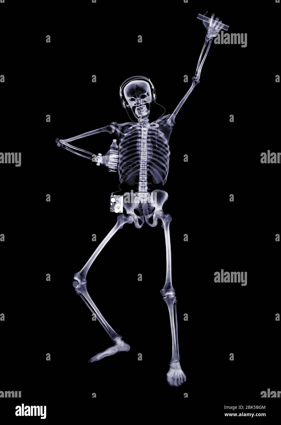 Persona bailando con una vara de luz, rayos X. Foto de stock