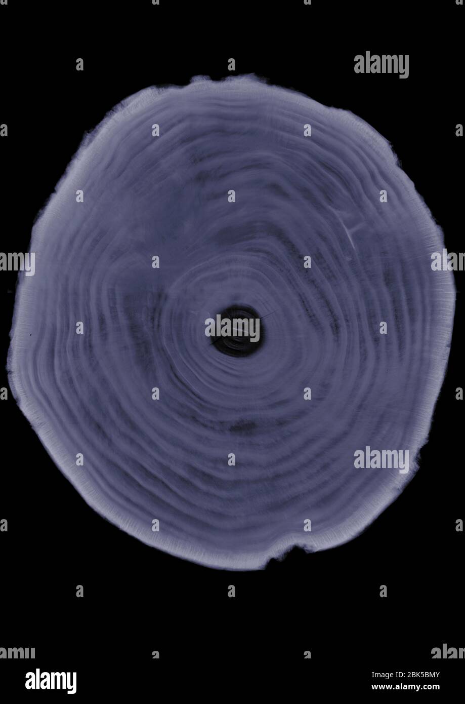Sección transversal del tronco del árbol, rayos X. Foto de stock