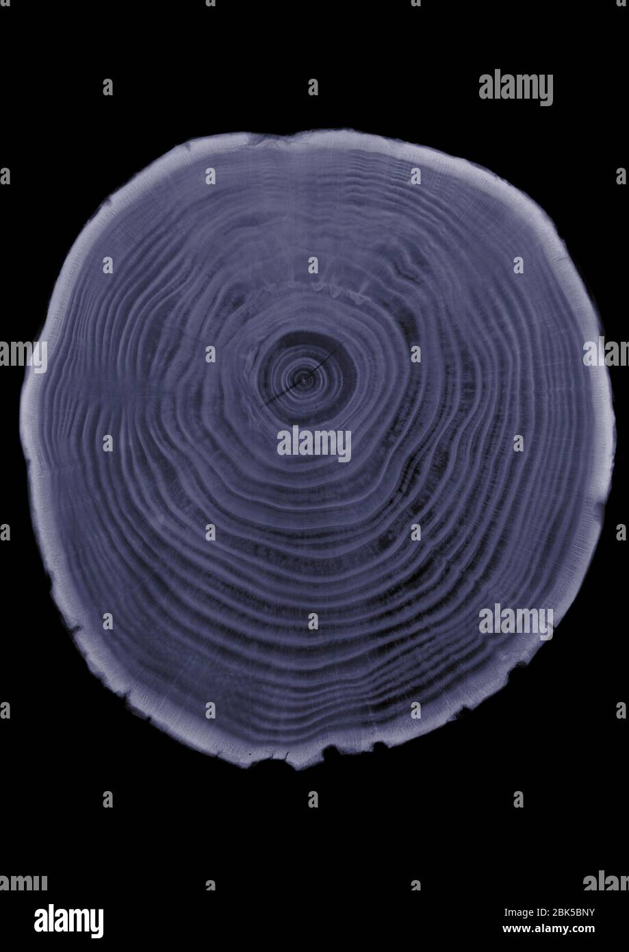 Sección transversal del tronco del árbol, rayos X. Foto de stock