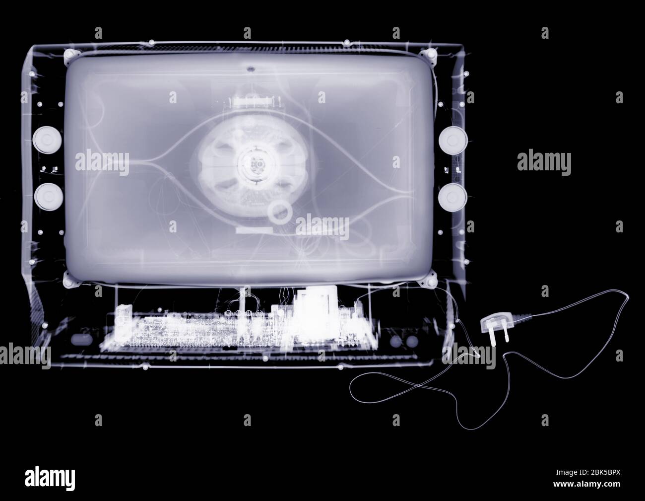 Televisión de pantalla ancha, rayos X. Foto de stock