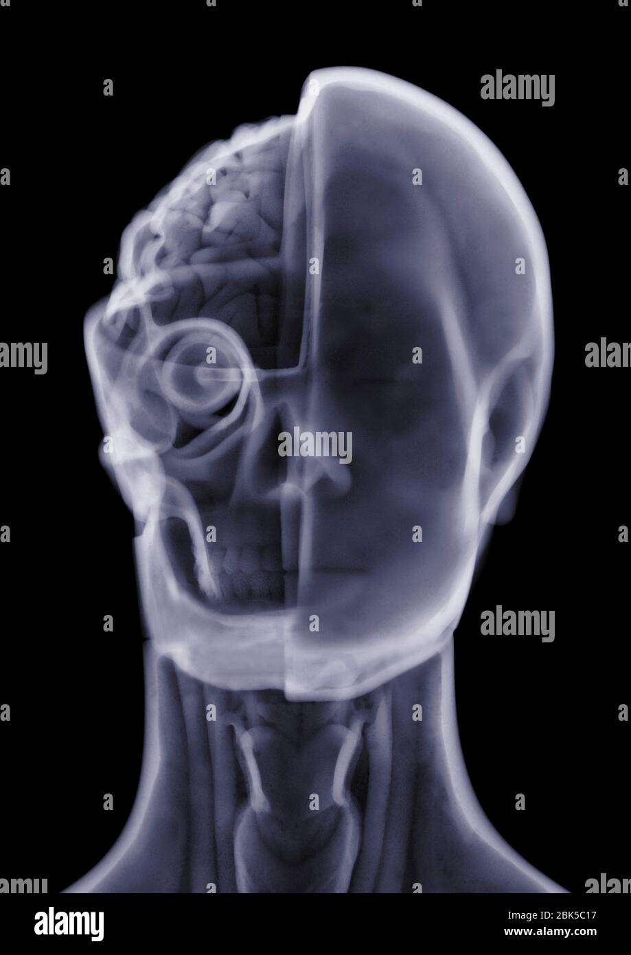 Modelo anatómico, rayos X. Foto de stock