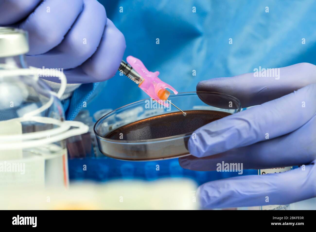 La enfermera prepara el cultivo de sangre en un plato de Petri preparado para experimentar, imagen conceptual Foto de stock