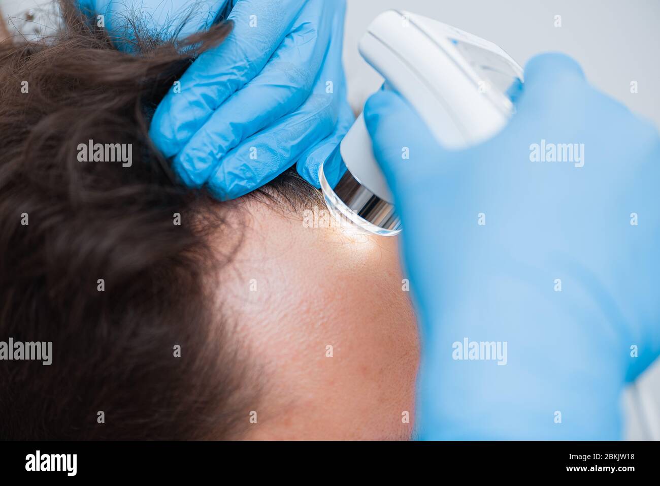 Trictoscopia de cabello y cuero cabelludo primer plano. Trichoscopio en  manos de un médico. Procedimiento de examen del cuero cabelludo y el  cabello Fotografía de stock - Alamy