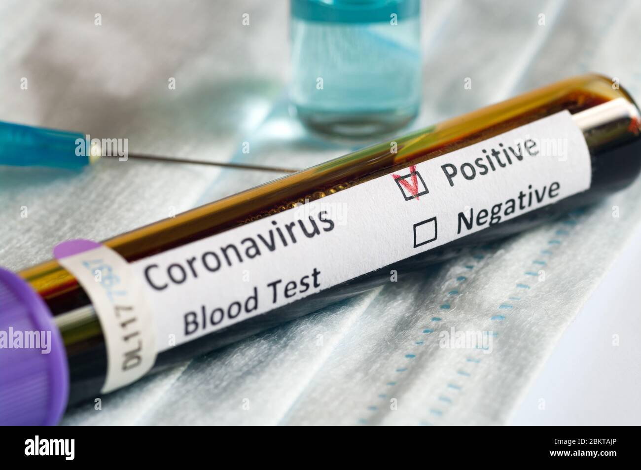 Tubo de muestra de sangre positivo con COVID-19 o coronavirus nuevo SARS-CoV-2. Foto de stock