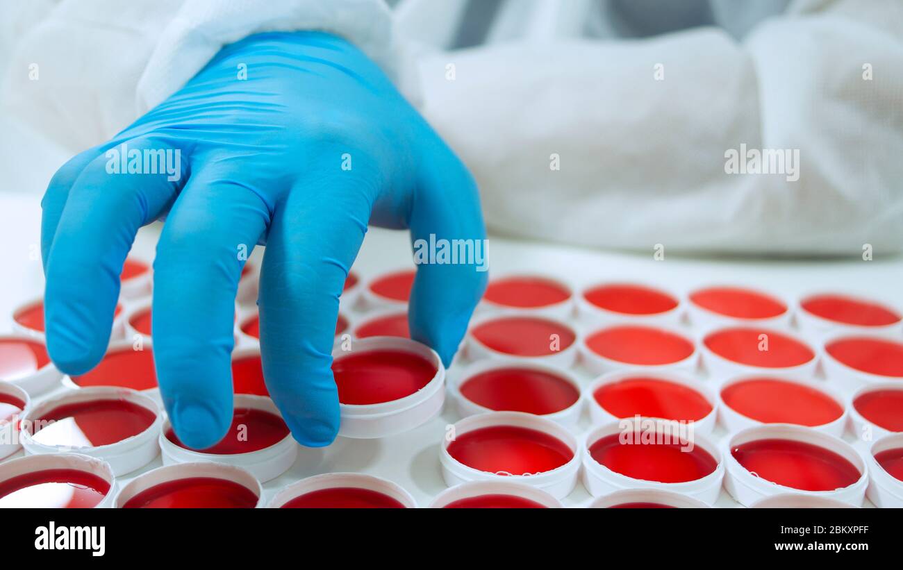 Mano de médico de cerca con guante azul levantando con sus dedos un recipiente blanco redondo de un grupo de muestras clínicas rojas redondas sobre una superficie blanca Foto de stock