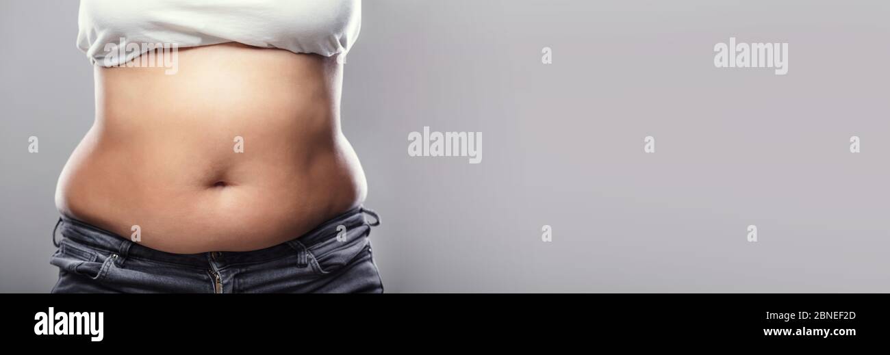 Pérdida de grasa y peso en el vientre. Sobrepeso Mujer estómago Foto de stock