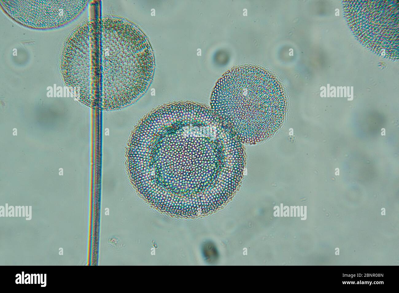 diatomeas marinas bajo el microscopio