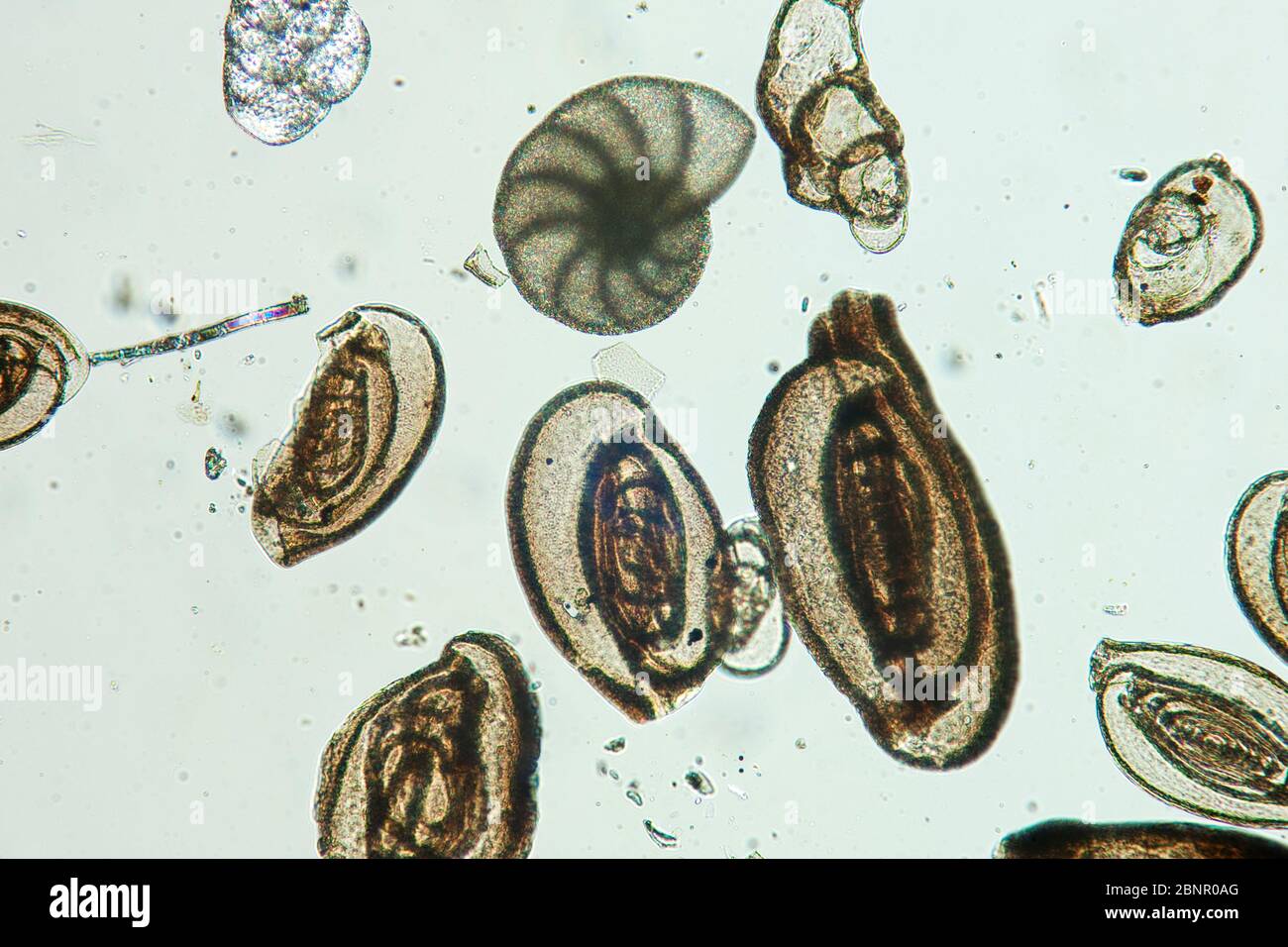 Foraminíferos protistas ameboides del Mar Adriático, fotomicrografía en luz polarizada simple Foto de stock