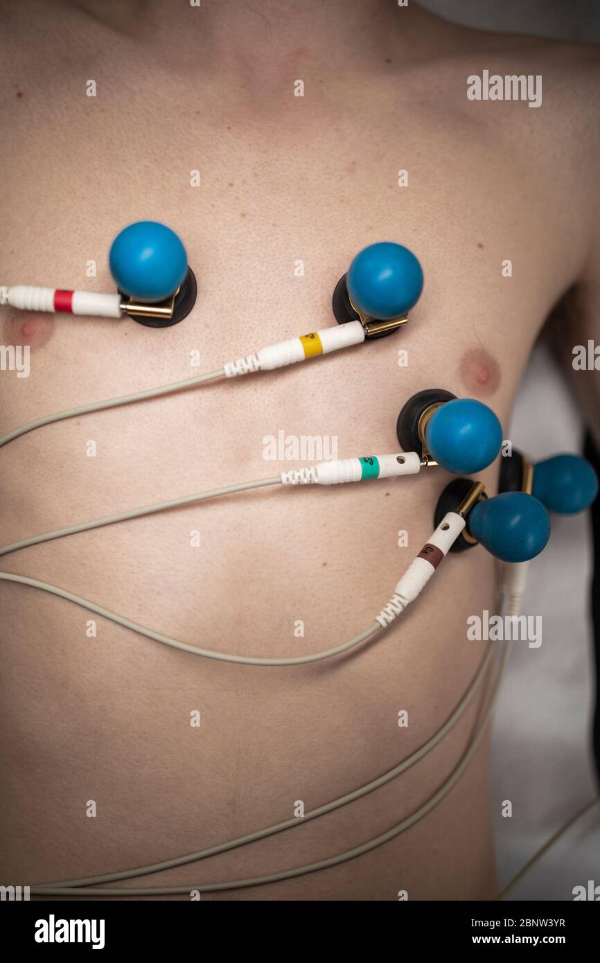 Un paciente con electrodos de ECG conectados a su cuerpo Fotografía de  stock - Alamy