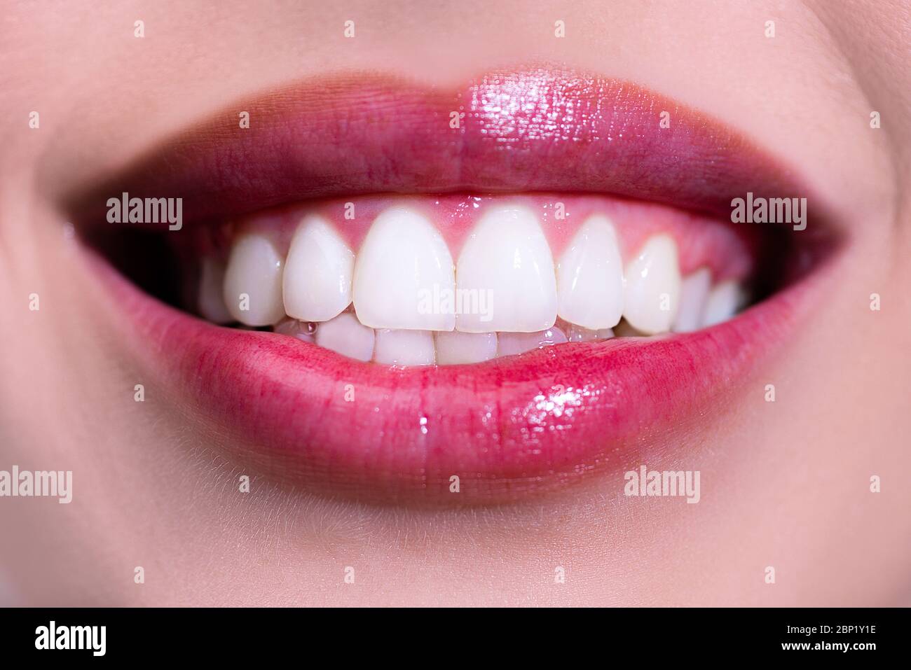 Mujer riendo boca con dientes grandes. Una sonrisa perfecta después del  blanqueo. Cuidado dental y blanqueamiento dental. Sonrisa saludable,  sonriendo Fotografía de stock - Alamy