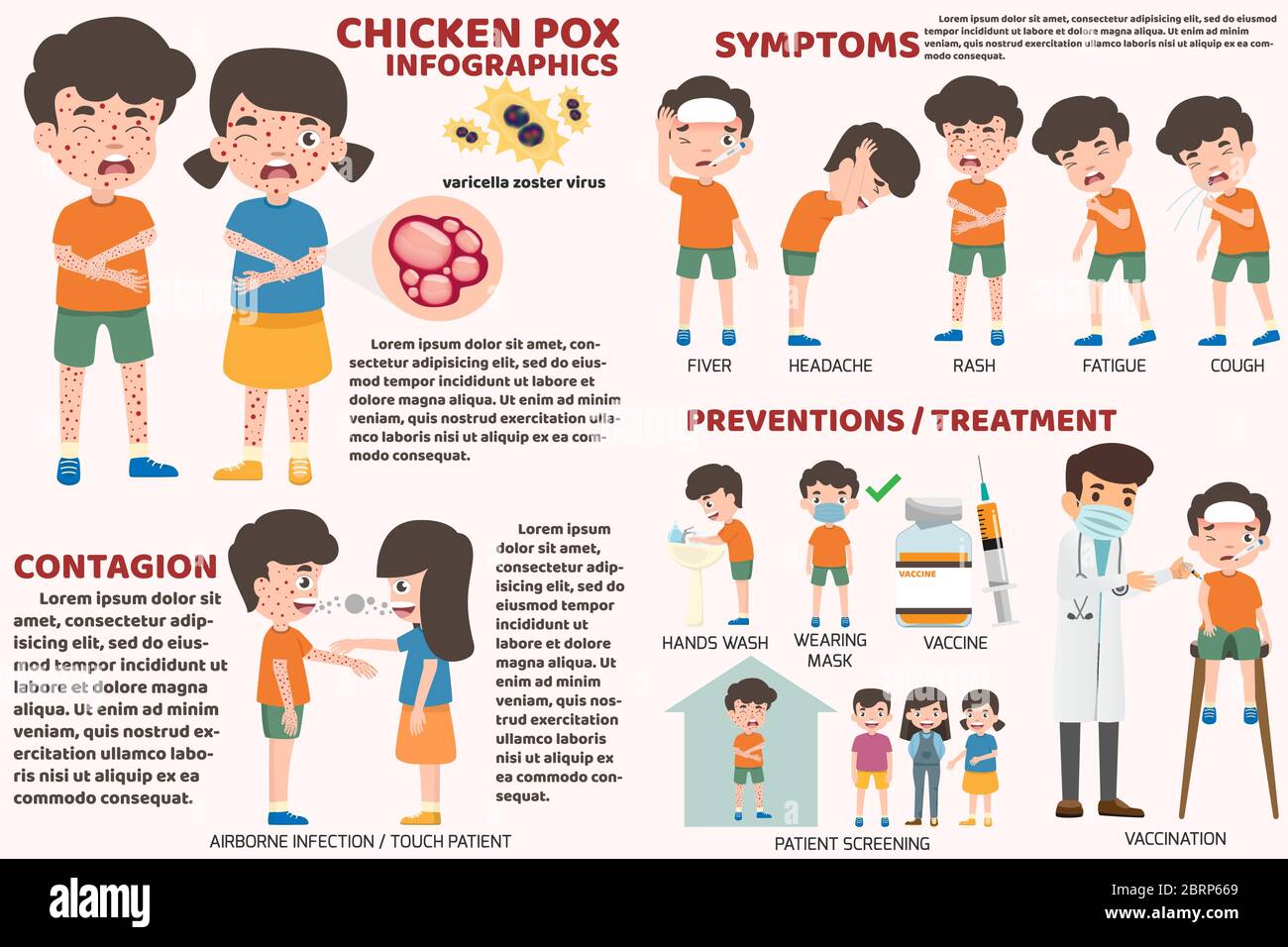 Los niños tienen la varicela infografía, los niños pósteres fiebre y