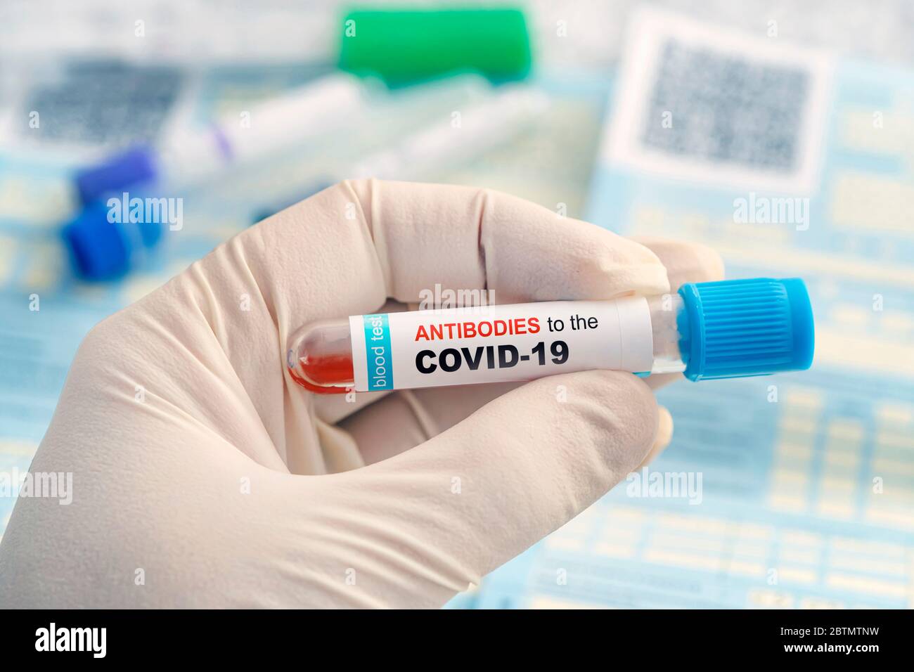 Prueba para detectar anticuerpos contra la infección por coronavirus. Comprobación de la inmunidad de la población a covid 19. Un tubo de análisis con un análisis de sangre en manos de un médico Foto de stock