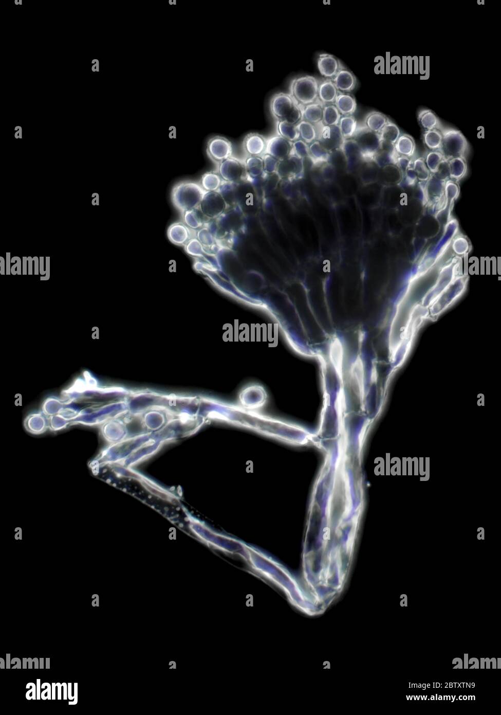 Penicillium moho bajo el microscopio, campo oscuro, 100x objetivo de aceite Foto de stock