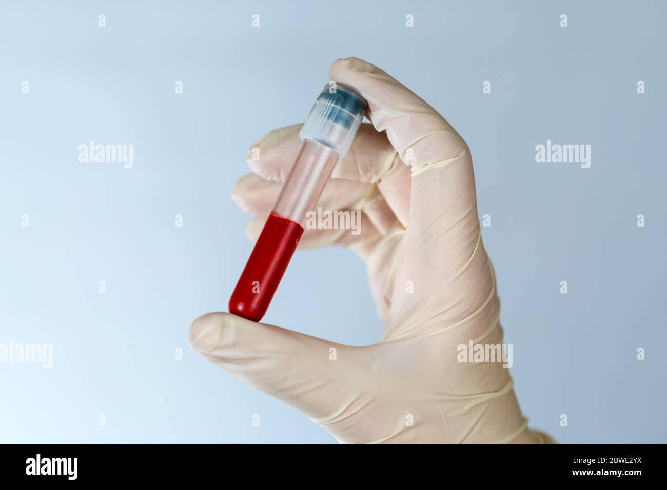 Tubo de ensayo con una muestra de sangre en las manos de una enfermera.  Análisis de sangre para virus en la clínica con la observancia de las  precauciones Fotografía de stock -