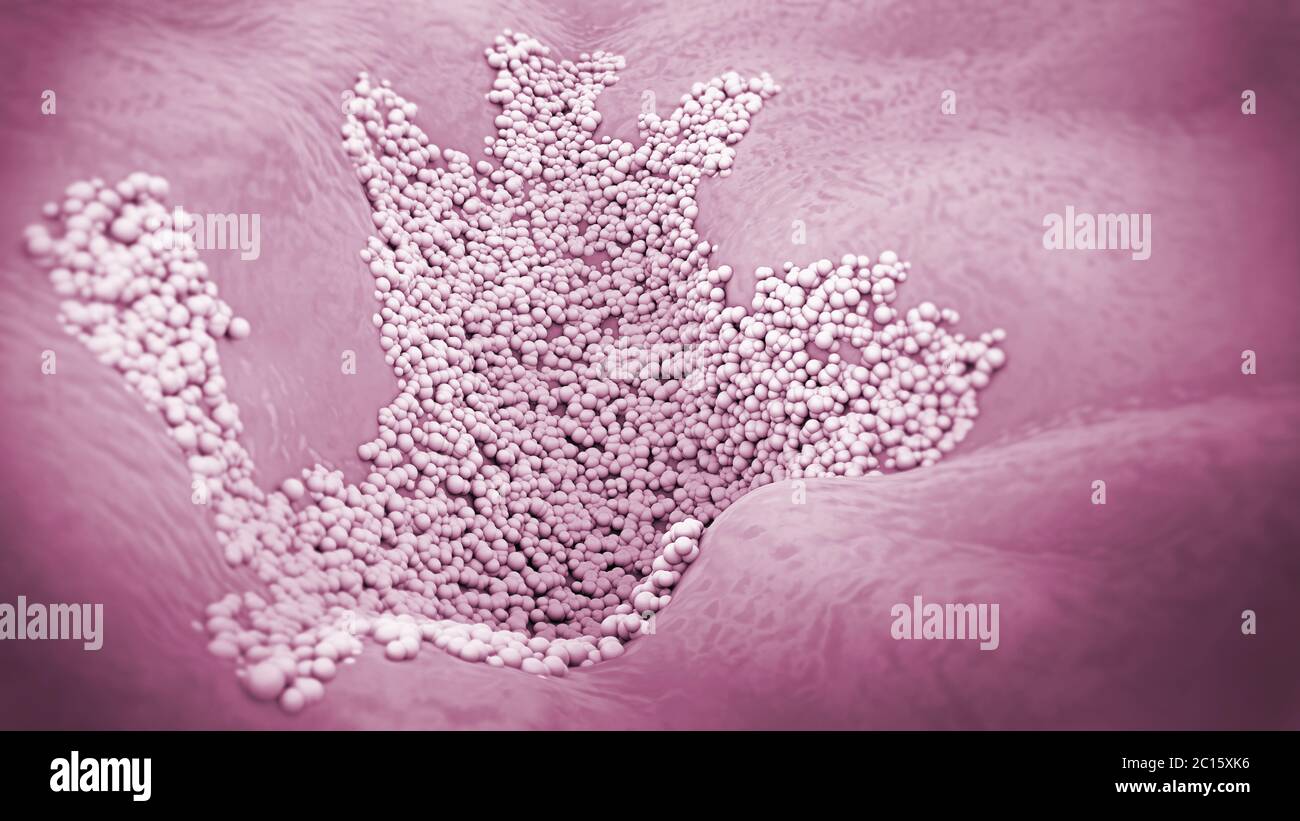 Primer plano microscópico de una infección micótica de la capa superior de la piel, llamada micosis de la piel - ilustración 3d Foto de stock