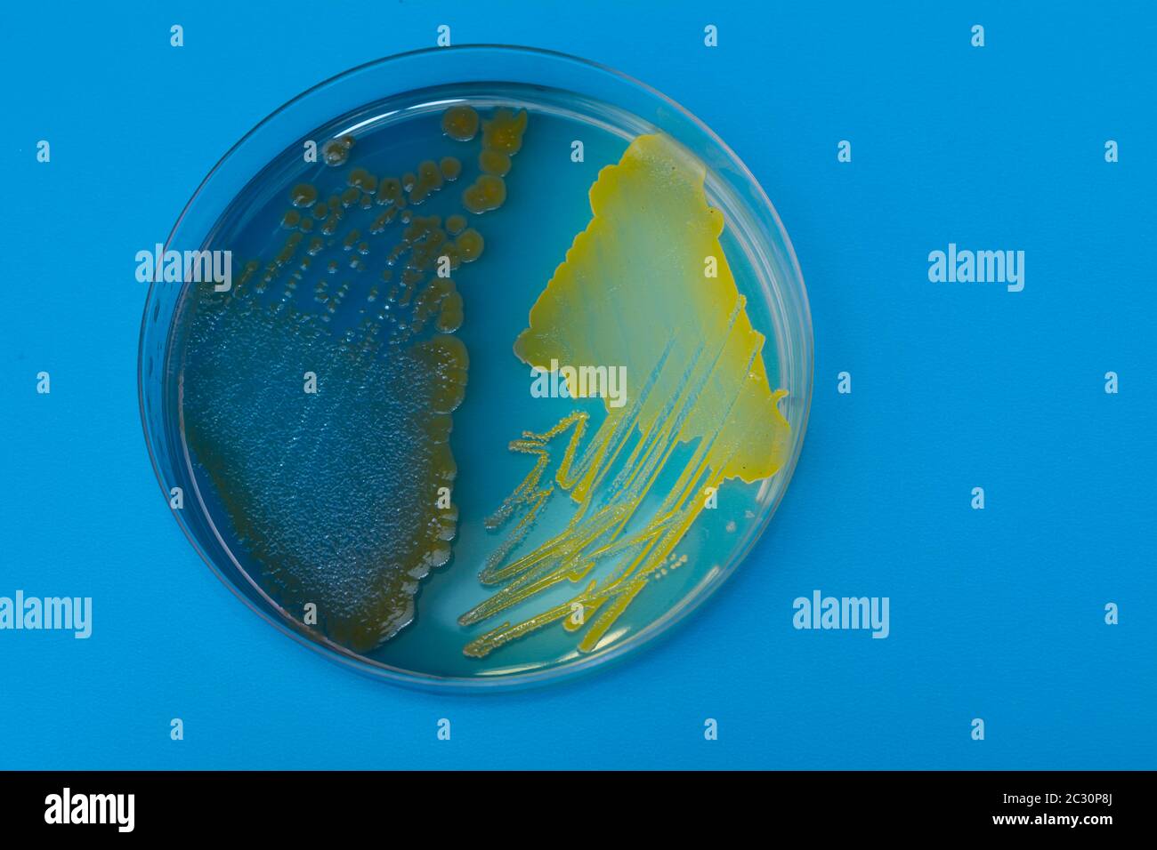 Placa de Petri con bacterias sobre fondo azul. Bacterias Staphylococcus aureus y pseudomonas aeruginosa en agar Foto de stock