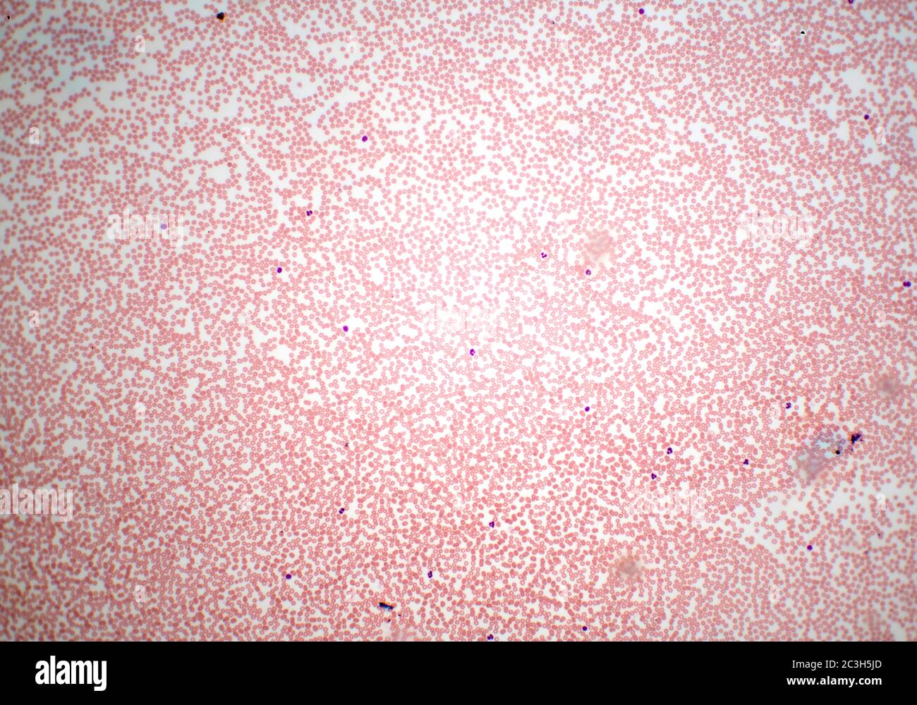 Muestra de sangre de células humanas en portaobjetos de microscopio  Fotografía de stock - Alamy