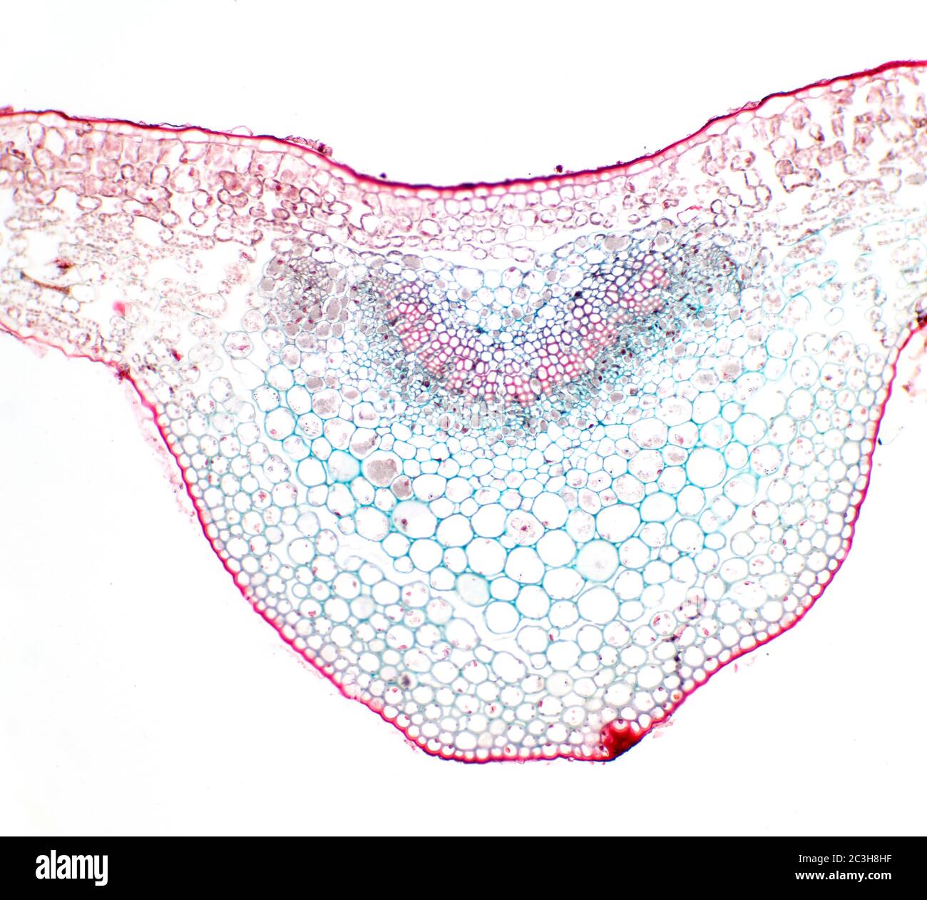 Sección transversal de la hoja Prunus, vista del microscopio Foto de stock