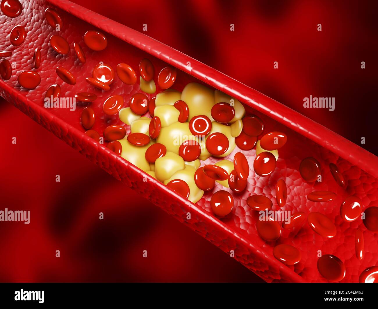 Glóbulos rojos humanos sanos y placas de colesterol. concepto de representación 3d Foto de stock