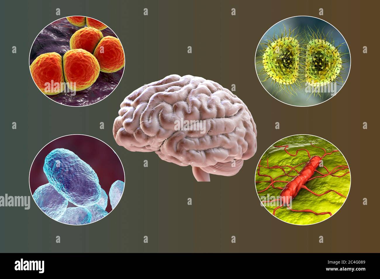 Causas de la meningitis bacteriana, ilustración por computadora